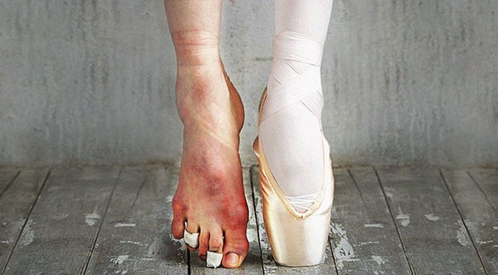 El costo de los aplausos: fotografías que retratan la realidad del ballet